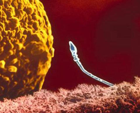 Здоровый спермий